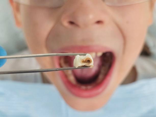 Best Emergency Denture Repair in Crompond, NY