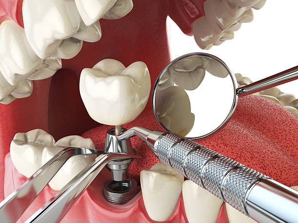 Best Emergency Gum Treatment in Crompond, NY